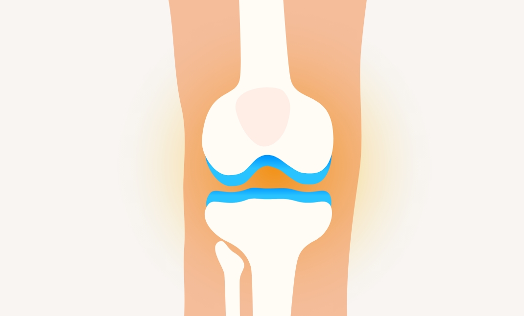 関節の潤滑が良くなり痛みが緩和
