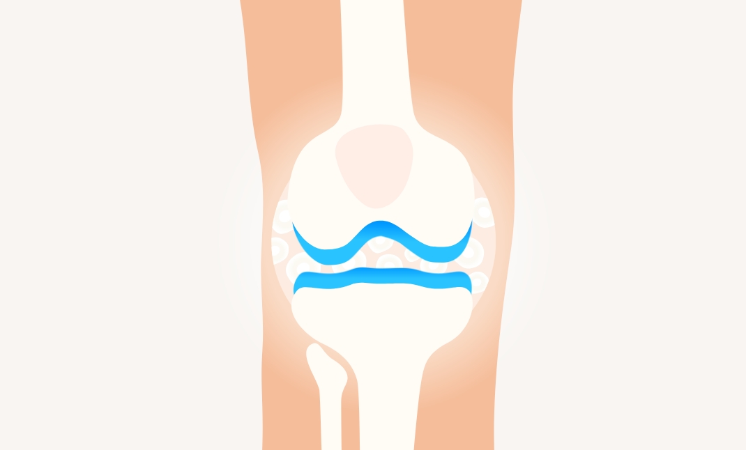 損傷した箇所の修復を促し、痛みが緩和