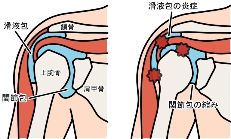 どうすればわかりますか?
