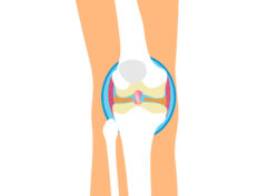 内側側副靱帯損傷とは？