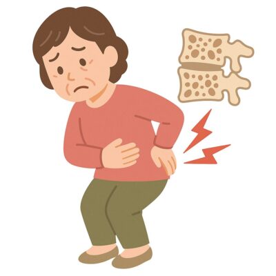 骨粗鬆症による腰痛とは？骨折のリスクと治療法を専門医が解説