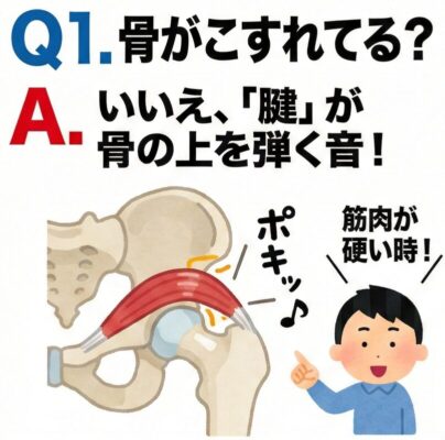 股関節がポキポキ鳴る原因は？よくある7つの質問に専門医がやさしく回答