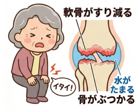 正座ができないのはなぜ？膝の痛みの原因と曲げやすくする対策を整形外科専門医が解説