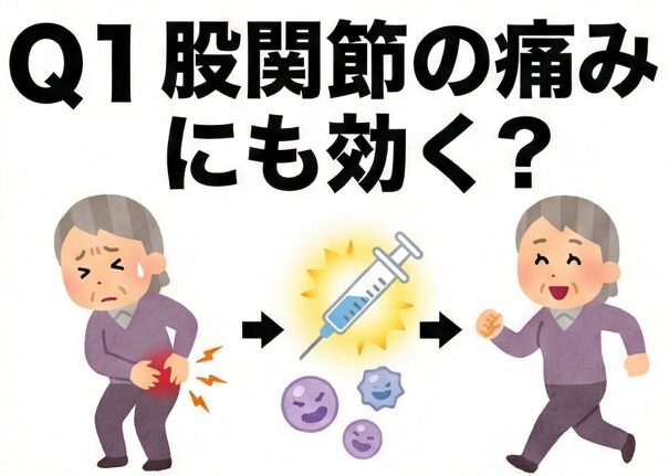 股関節の再生医療でよくある8つの質問に専門医がやさしく回答