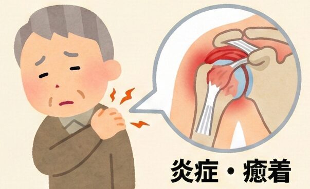 肩の可動域改善でよくある8つの質問に専門医がやさしく回答