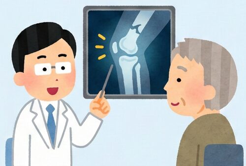 膝の痛みは何科に行けばいい？整形外科と接骨院の違いと正しい選び方を専門医が解説