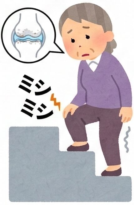 膝がポキポキ鳴る原因は？よくある8つの質問に専門医がやさしく回答