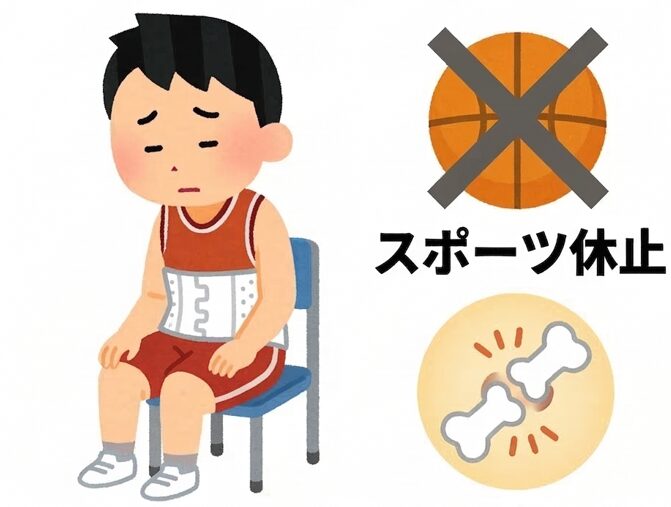 腰椎分離症でよくある8つの質問に専門医がやさしく回答