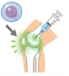 手術したくない方必見！膝の痛みを抑えて一生歩くための最新治療と対策