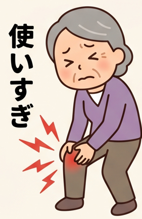 膝のオーバーユースでよくある8つの質問に専門医がやさしく回答