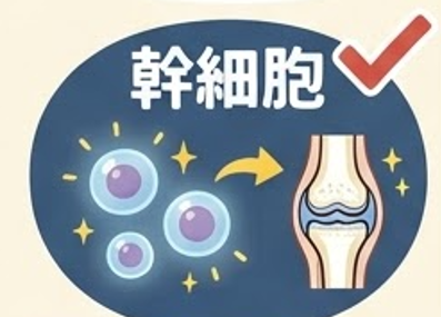 膝の幹細胞注射でよくある8つの質問に専門医がやさしく回答