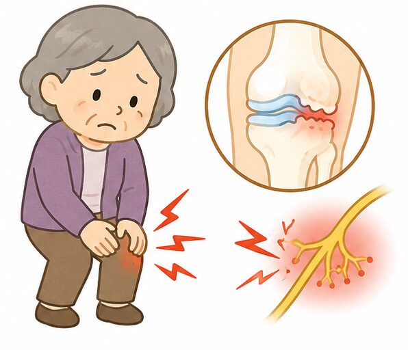 膝がピリピリ痛むときに考えたい神経性の痛みとは？原因と対処法を専門医が解説